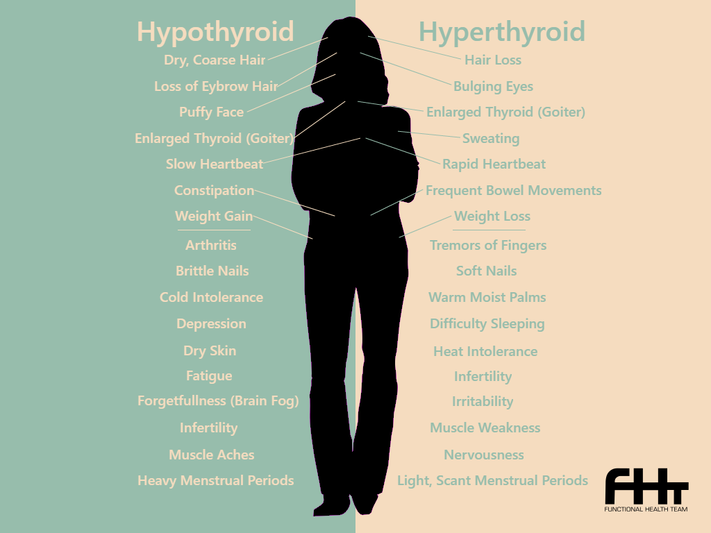 Thyroid Disease: Possibly the most misdiagnosed, poorly treated ...